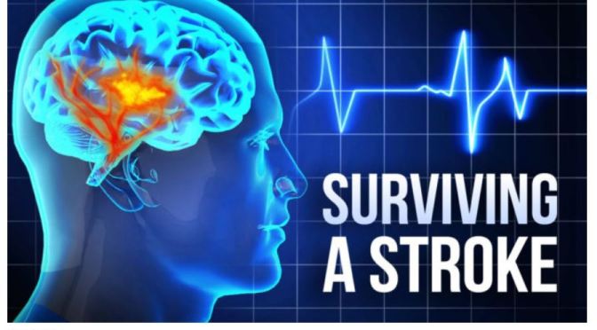 Health Studies: Lowering LDL Cholesterol Below 70 MG/DL Markedly Lowers Risk Of Recurrent Strokes
