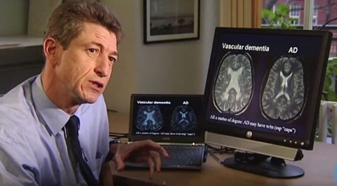 Health: “Key Techniques in Diagnosing Dementia”
