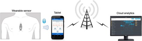 Data collected by the sensor are streamed to a phone and then encrypted and uploaded to a cloud analytics platform.