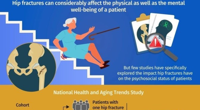 Infographic: Physical & Mental Impact Of Hip Fractures On The Elderly
