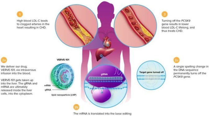 Heart Disease: New Gene-Editing Technology To Lower ‘Bad Cholesterol’