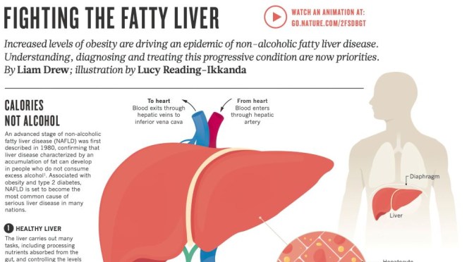 Infographic: Fighting Fatty Liver Disease