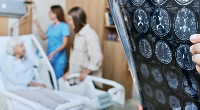Medicine: AI Verifies ‘Brain Age’ To Detect Alzheimer’s